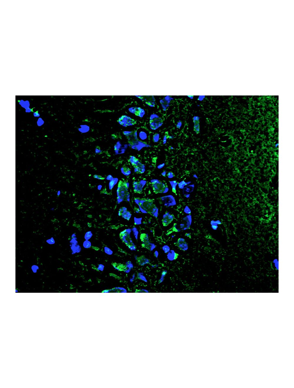 Fluoro-Jade C (FJC) Ready-to-Dilute Staining Kit for identifying  Degenerating Neurons